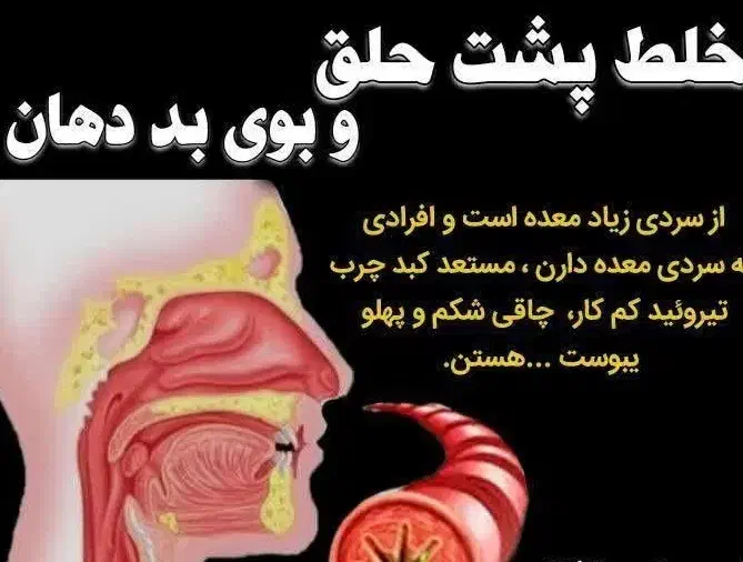 نه به آنتی بیوتیک برای خلط پشت حلق|خدمات آرایشگری و زیبایی|دورود, |دیوار