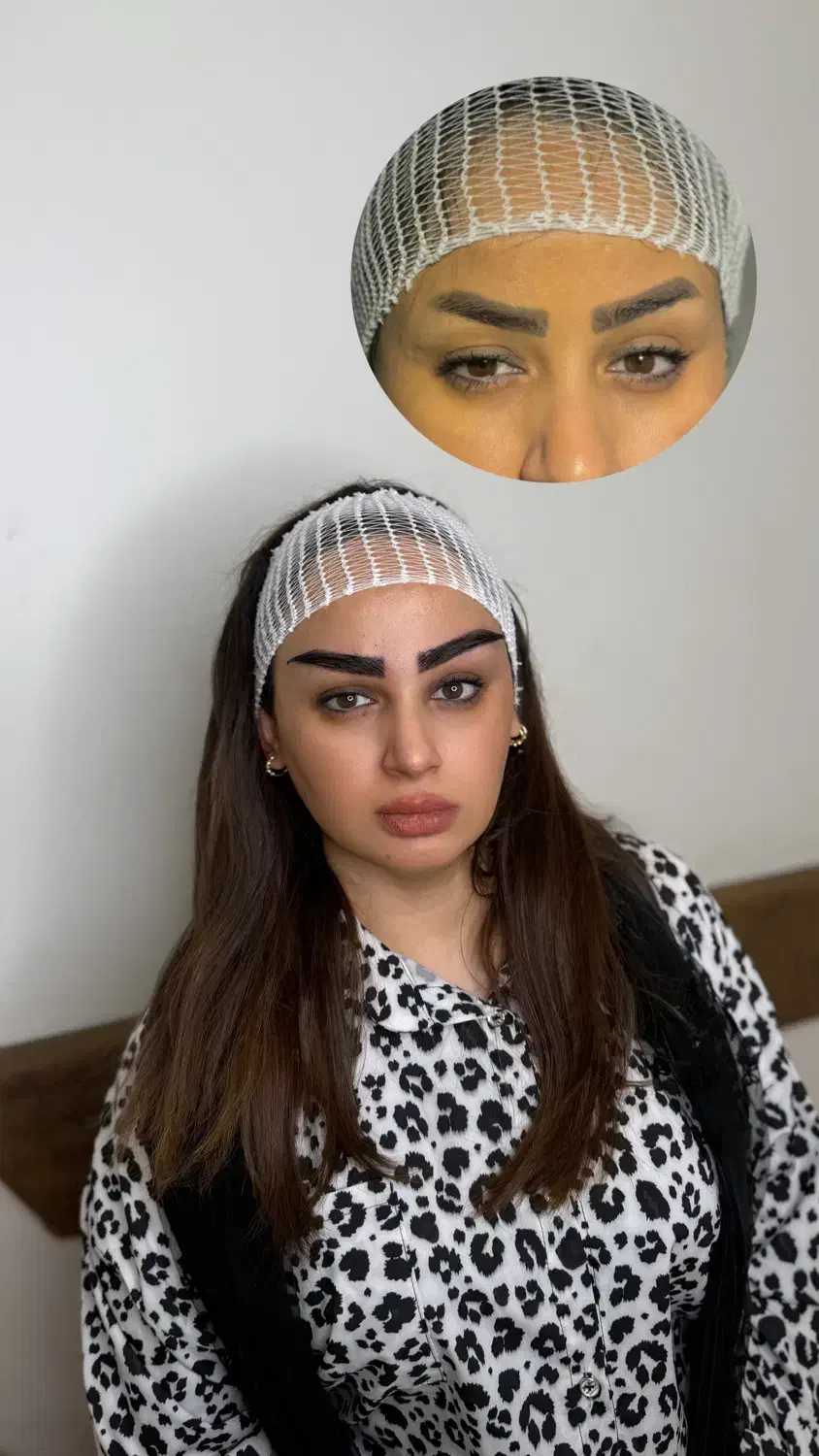 کاشت ابرو دائمی بدون بخیه بدون برش با خواب طبیعی|خدمات آرایشگری و زیبایی|تبریز, |دیوار