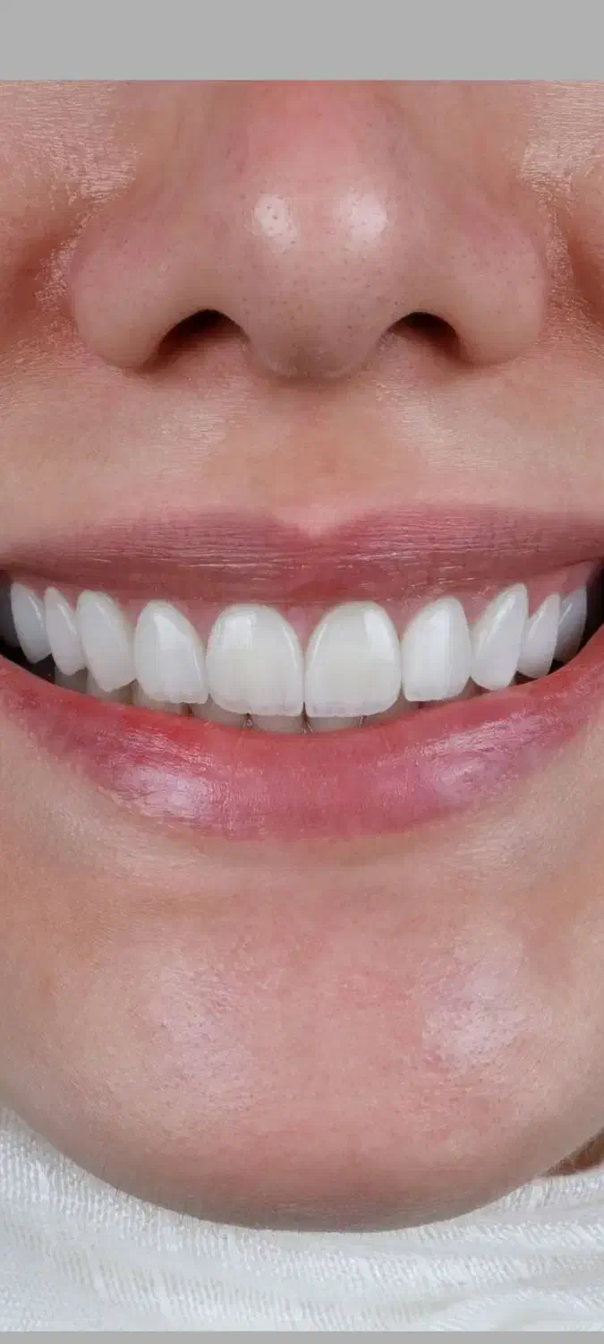 به یک دستیار دندانپزشک نیازمندیم|استخدام درمانی، زیبایی، بهداشتی|فردیس, فردیس|دیوار