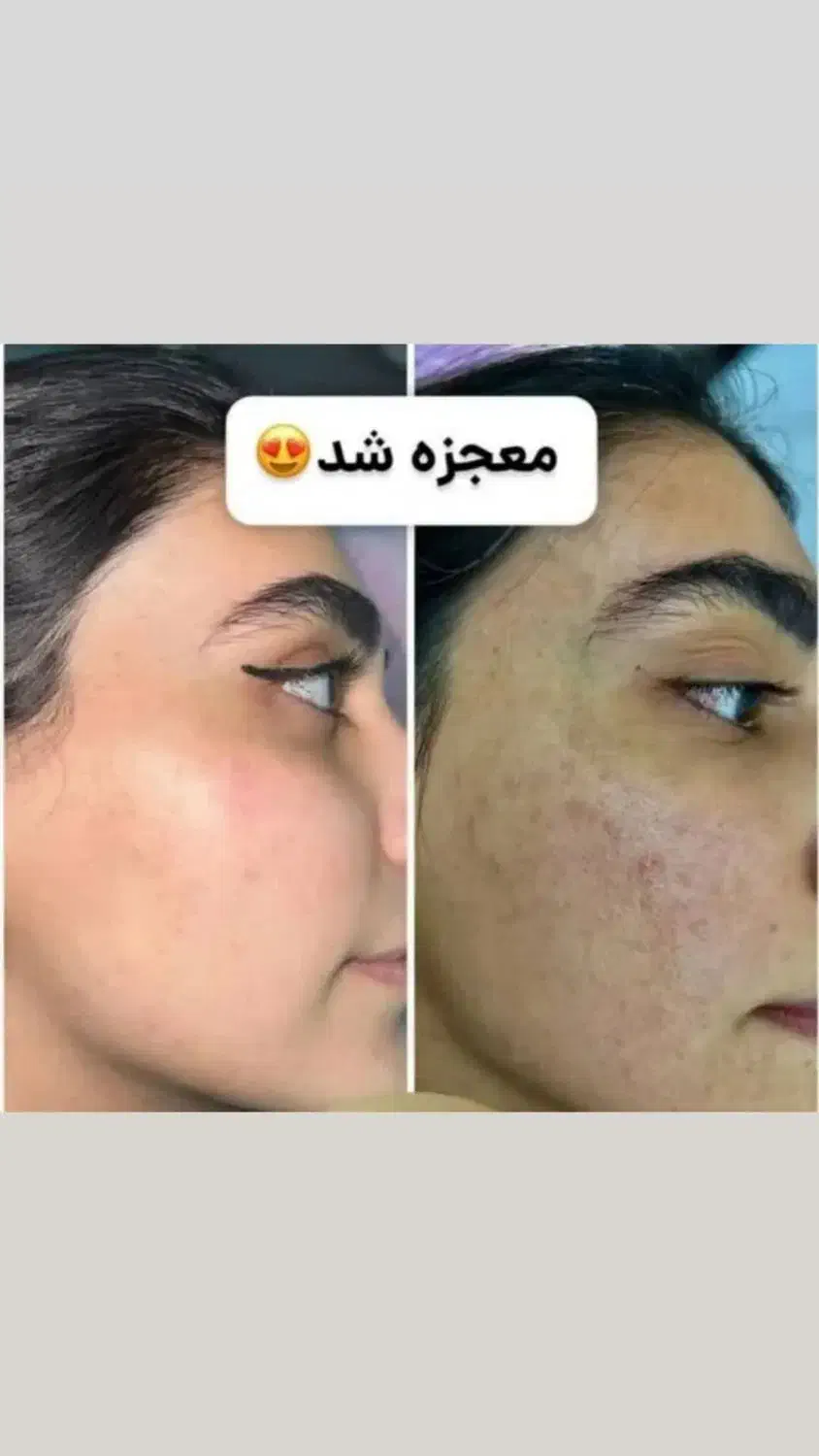 طب سنتی. سلامتکده|آرایشی، بهداشتی، درمانی|خاش, |دیوار