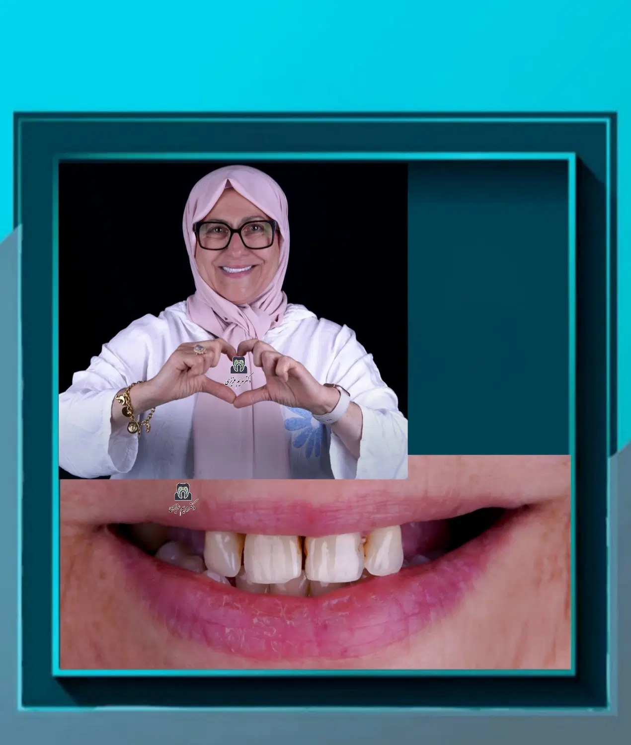 ایمپلنت دندانپزشکی ، رضایتمندی بالا ، تعرفه دولتی|خدمات زیبایی و سلامت|شیراز, ملاصدرا|دیوار