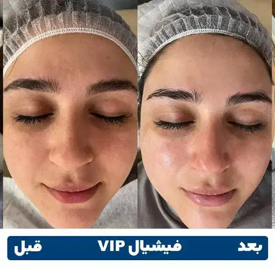 اموزش فیشیال و اکستنشن فقط ۴ تومن و ۳ تومن|خدمات آرایشگری و زیبایی|تهران, شهرک ولیعصر جنوبی|دیوار