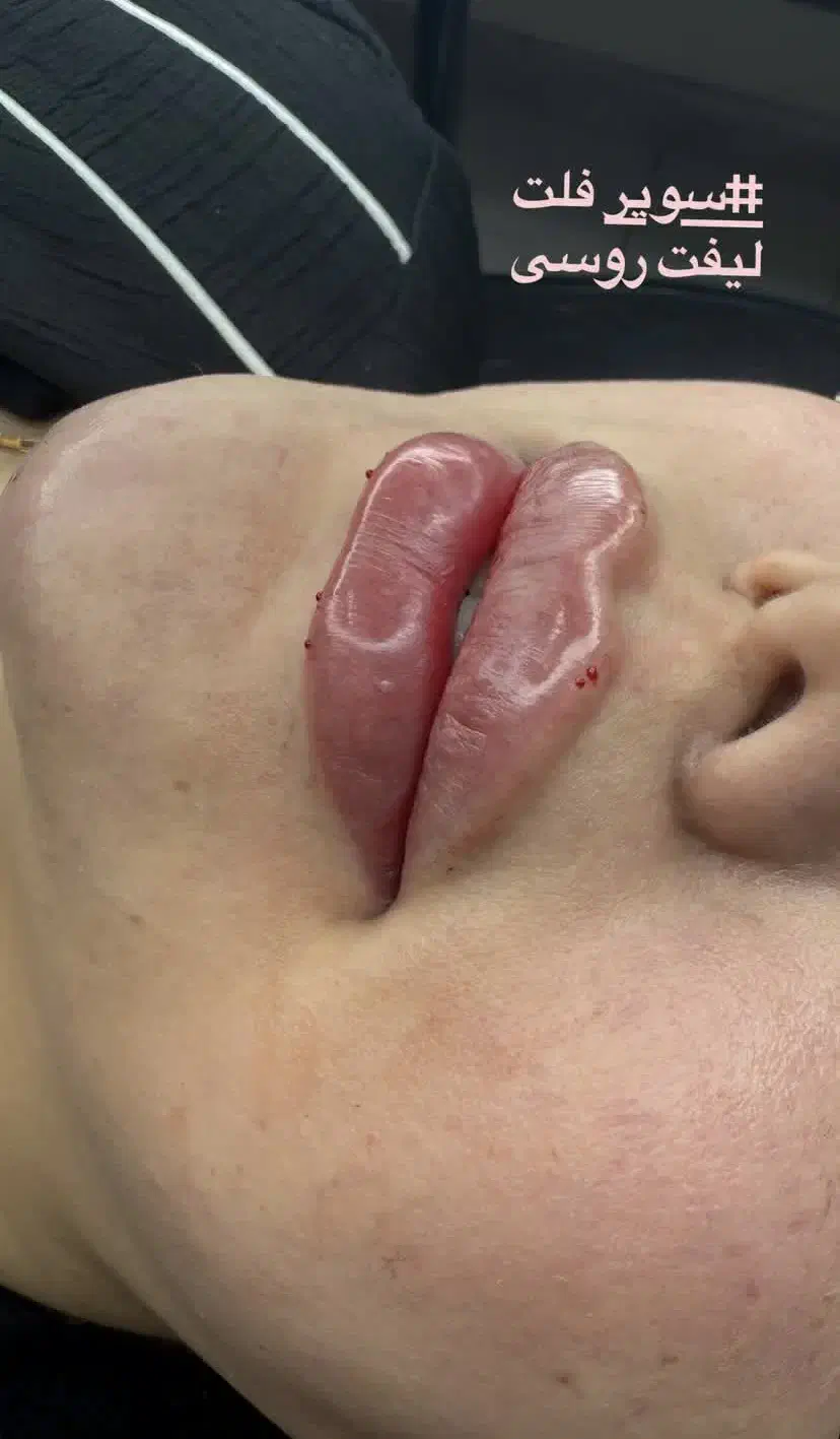 لب روسی تکنیک M وکانتورینگ نچرال و عروسکی|خدمات آرایشگری و زیبایی|اصفهان, ملکشهر|دیوار