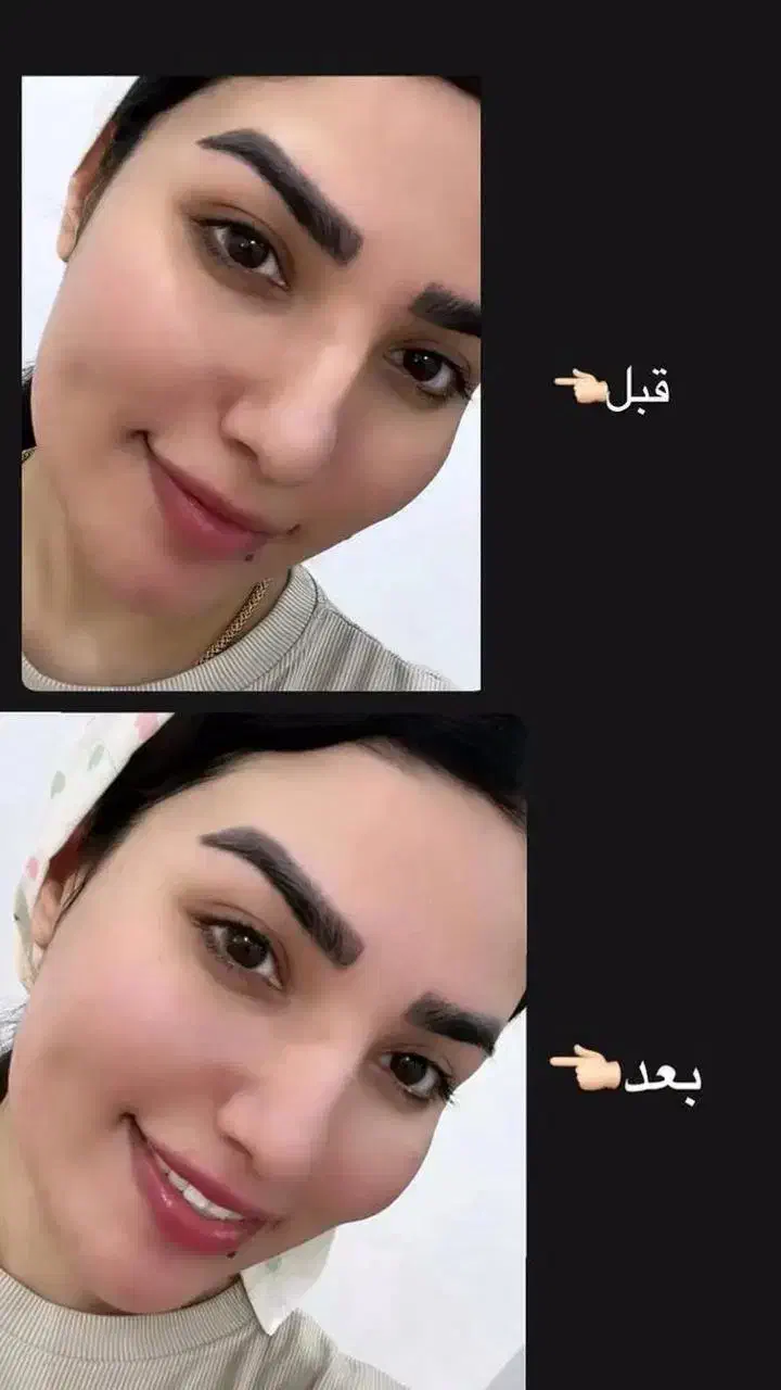 صابون کربن|آرایشی، بهداشتی، درمانی|کشکسرای, |دیوار