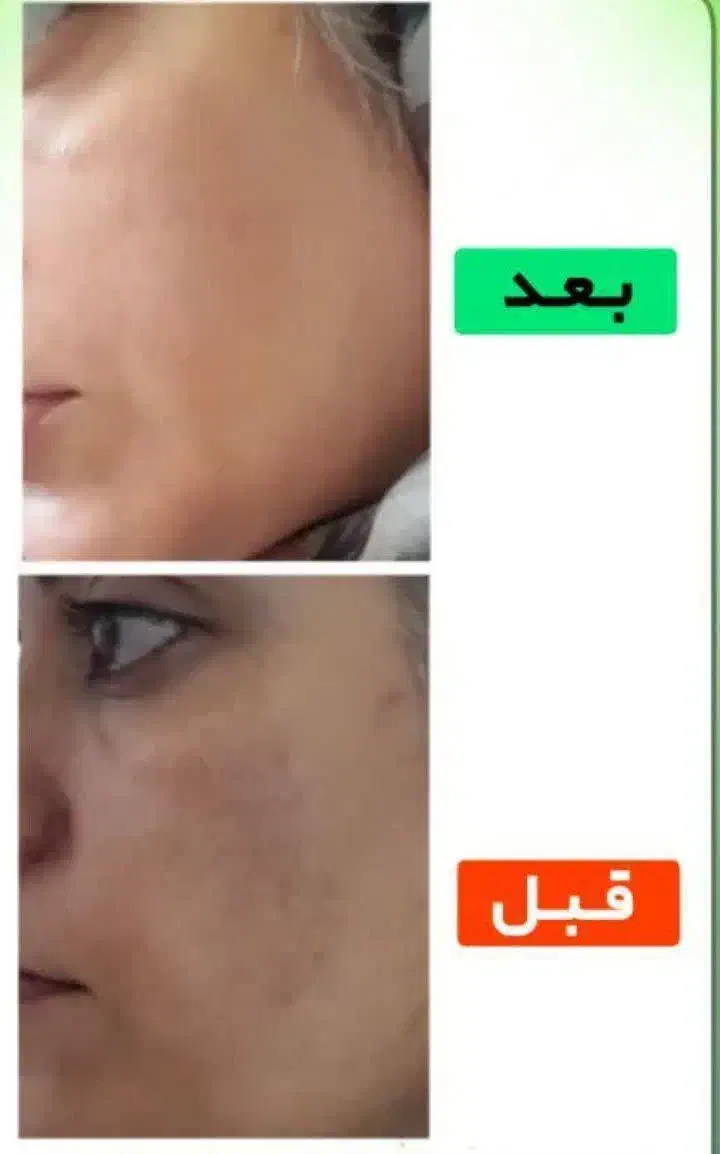 روغن تراپی|آرایشی، بهداشتی، درمانی|نهبندان, |دیوار