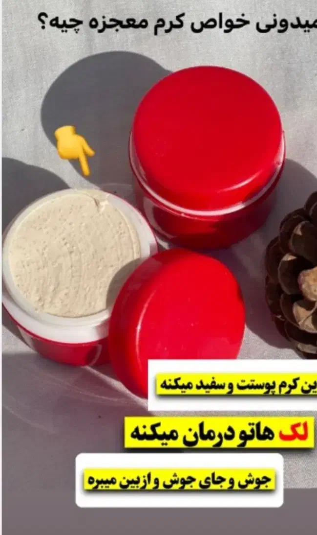 کرم معجزه سوپر بشرط جوابدهی 3روزه|آرایشی، بهداشتی، درمانی|اهواز, پردیس|دیوار