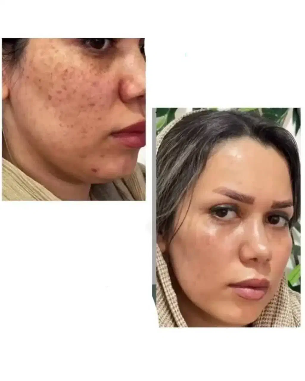 پاکسازی کبدچرب فقط در 40 روز|خدمات آرایشگری و زیبایی|گرگان, |دیوار