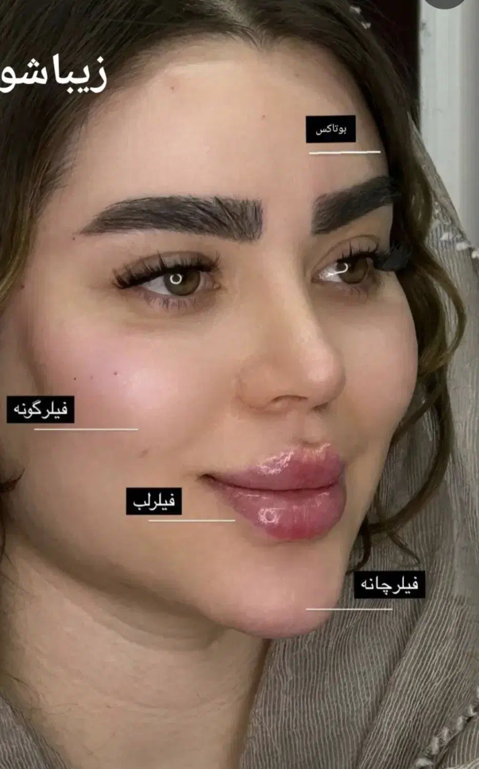 ساکشن غبغب شکم پهلو|خدمات آرایشگری و زیبایی|شیراز, عفیف‌آباد|دیوار