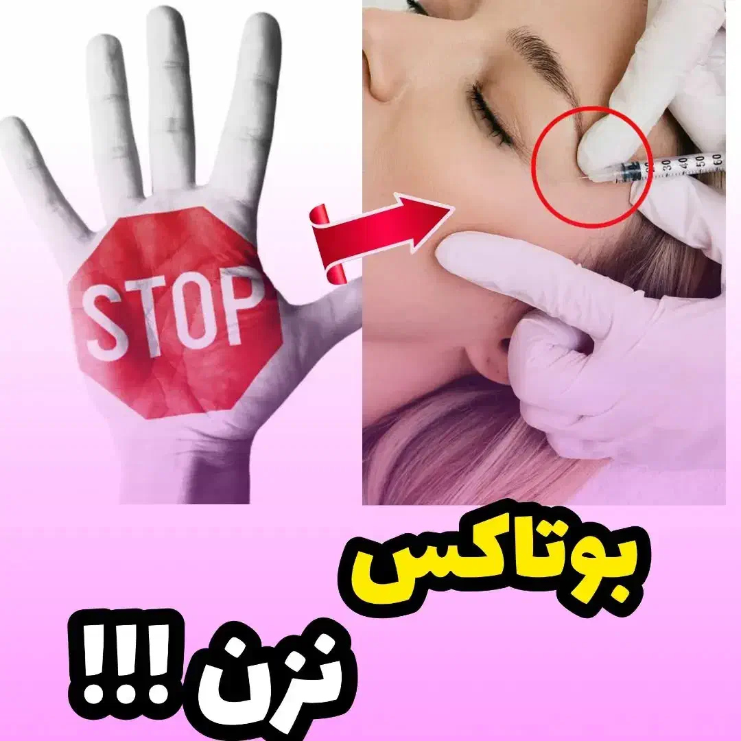کرم ۵ کاره گاتیو ایتالیایی|آرایشی، بهداشتی، درمانی|شیراز, شهرک گلستان|دیوار