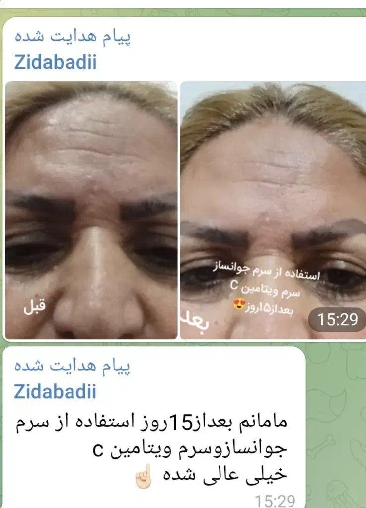 سرم جوانساز سلولهای بنیادی گل رز|آرایشی، بهداشتی، درمانی|شاهین‌شهر, امام حسین|دیوار