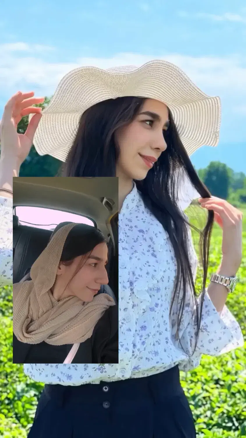جشنواره عمل بینی فقط با۲۵میلیون|خدمات زیبایی و سلامت|تهران, فلسطین (میدان انقلاب)|دیوار