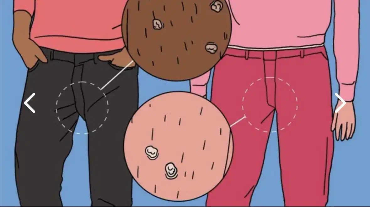 کلینیک درمان زگیل و تبخال|خدمات آرایشگری و زیبایی|چمستان, |دیوار