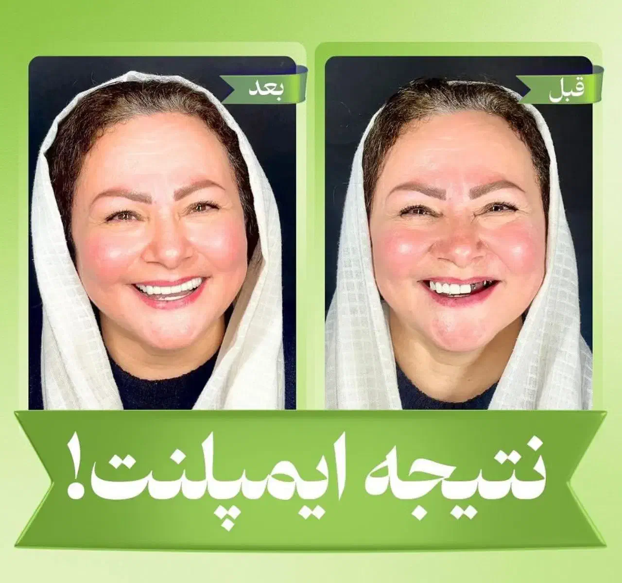 مرکز تخصصی ایمپلنت دیجیتال/اقساط/یکروزه/کاشت دندان|خدمات آرایشگری و زیبایی|تهران, پاسداران|دیوار