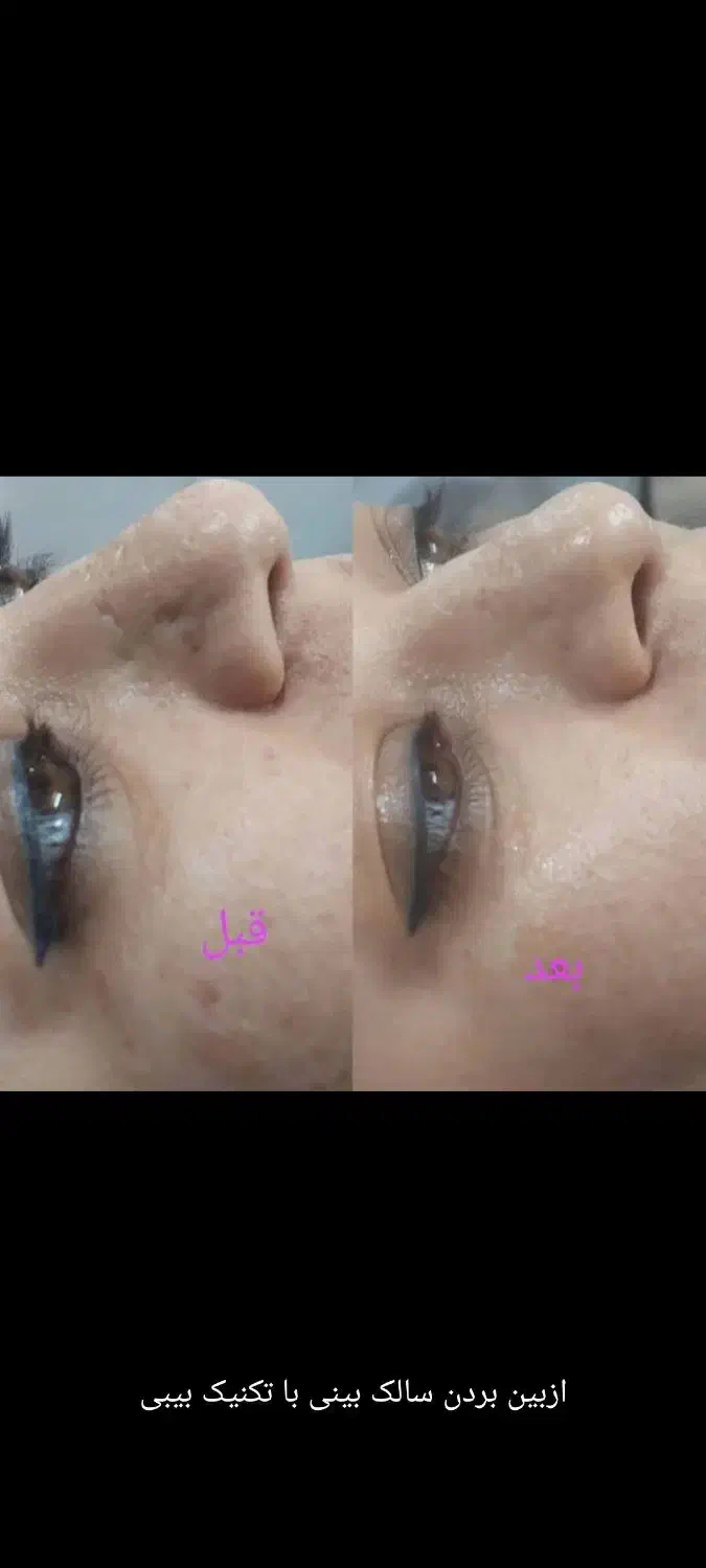 آموزش پی آر پی وپی آر اف|خدمات آموزشی|اصفهان, خانه اصفهان|دیوار