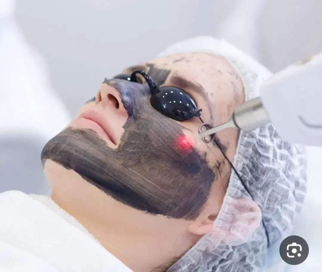 لیزر روشن کننده پوست و پاک کردن تتو|خدمات آرایشگری و زیبایی|رفسنجان, |دیوار