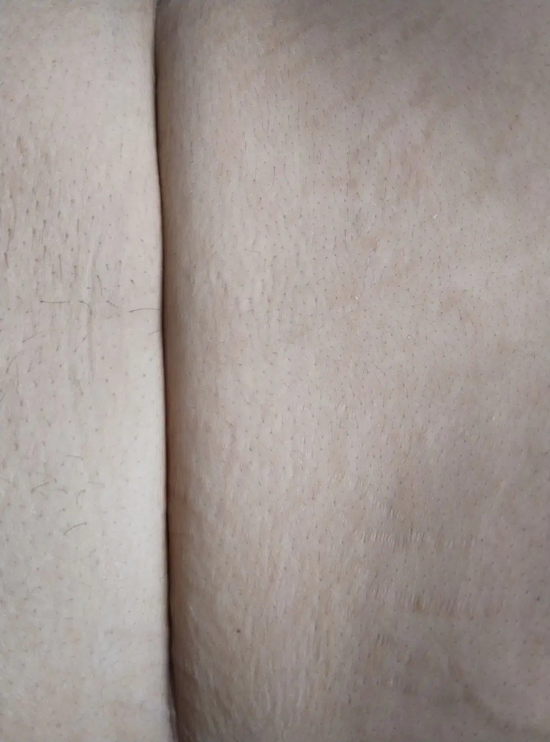 پلاسما .پلکسر|خدمات آرایشگری و زیبایی|زرند, |دیوار