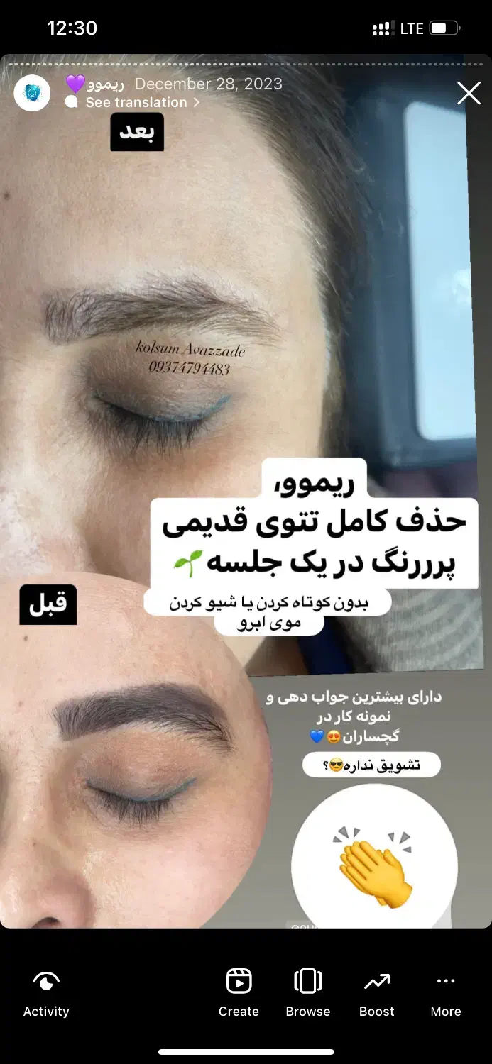 ریموو،پاک کردن تتوی صورت|خدمات آرایشگری و زیبایی|دوگنبدان, |دیوار