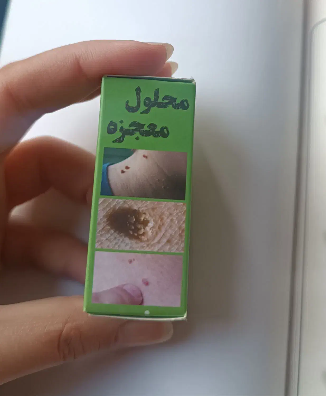 پاکسازی ۲۴ساعته زگیل و خال|آرایشی، بهداشتی، درمانی|تهران, چیتگر شمالی|دیوار