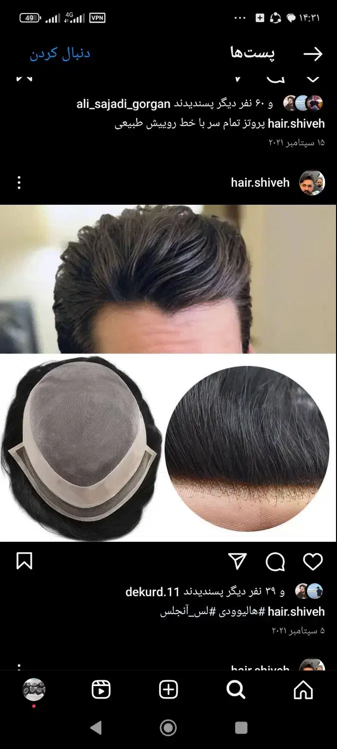 پروتز مو بافت مو ترمیم مو سجادی ارزانتر از همه جا|خدمات آرایشگری و زیبایی|تهران, جوادیه تهرانپارس|دیوار