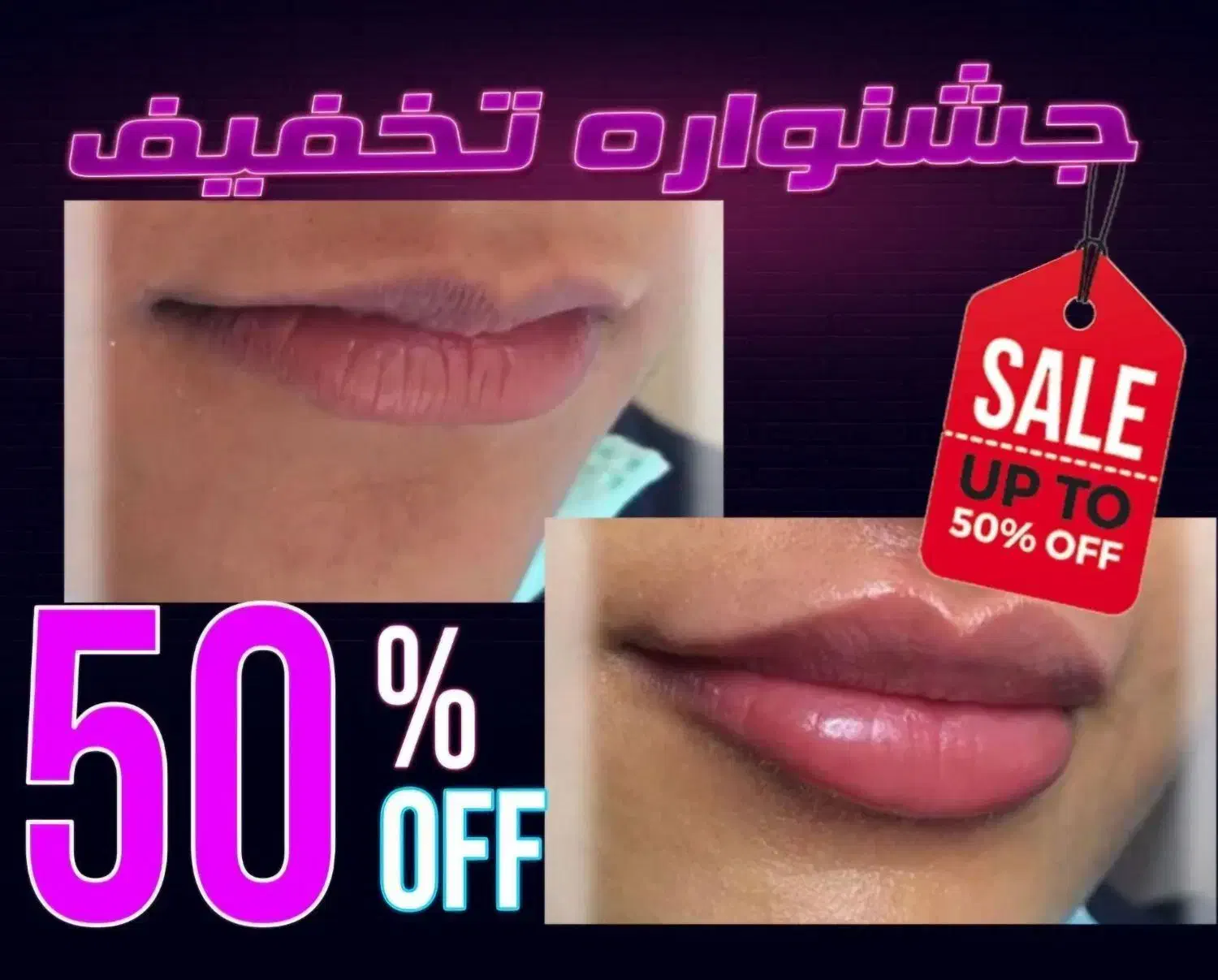 کلینیک تزریق ژل لب روسی فیلر چانه لیزر لیفت صورت|خدمات آرایشگری و زیبایی|تهران, صادقیه|دیوار