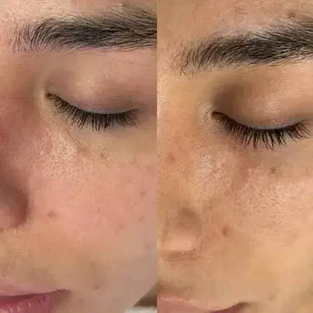 آموزش فشیال و درمان پوست (تخصصی پزشکی)|خدمات آموزشی|اردبیل, |دیوار