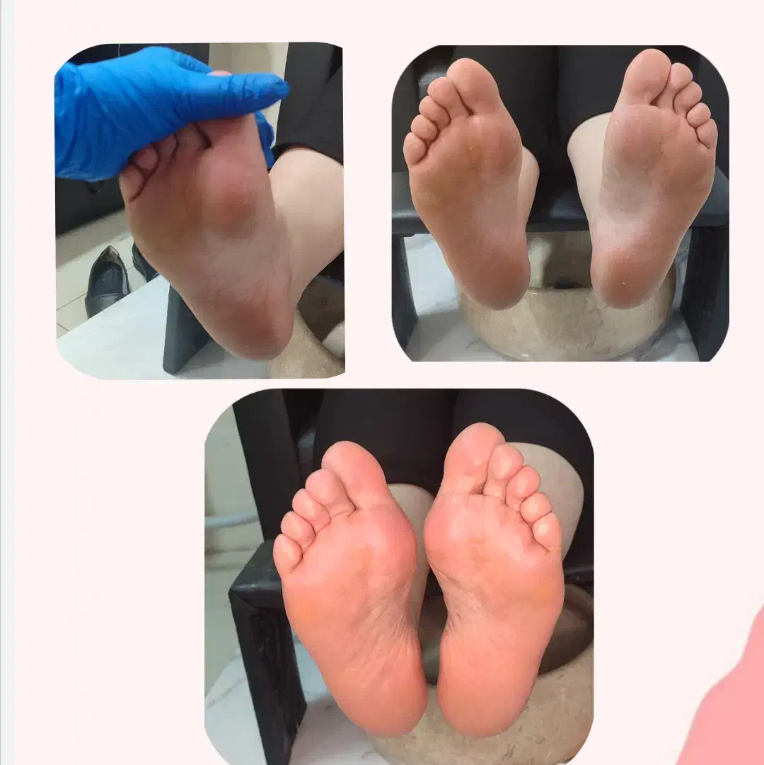 جشنواره پر تخفیف پدیکور|خدمات آرایشگری و زیبایی|مشهد, هفت تیر (آب و برق)|دیوار