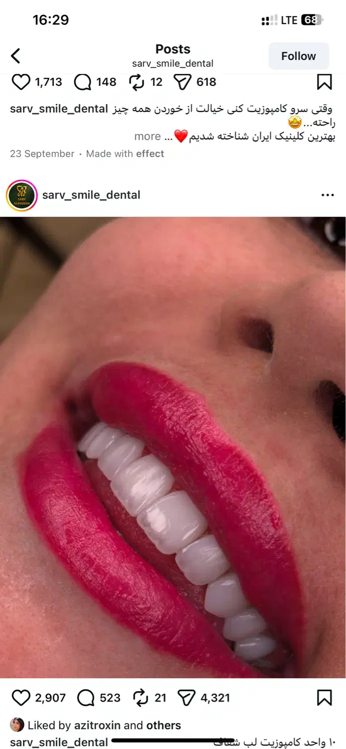 بزرگترین جشنواره تخفیفی کلینیک دندانپزشکی سرو|خدمات آرایشگری و زیبایی|تهران, قیطریه|دیوار