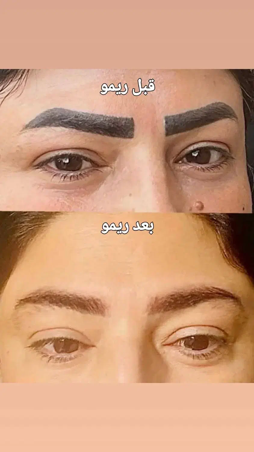 آموزش وانجام ریمو تک جلسه ای وآرایش دائم|خدمات آموزشی|بندر امام خمینی, |دیوار