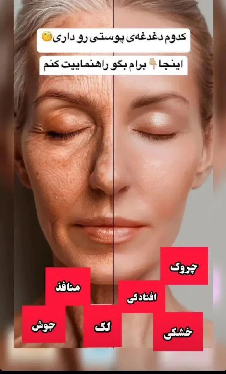 مشاوره درمانی پوست ومو|آرایشی، بهداشتی، درمانی|شاهین‌شهر, گرگاب|دیوار