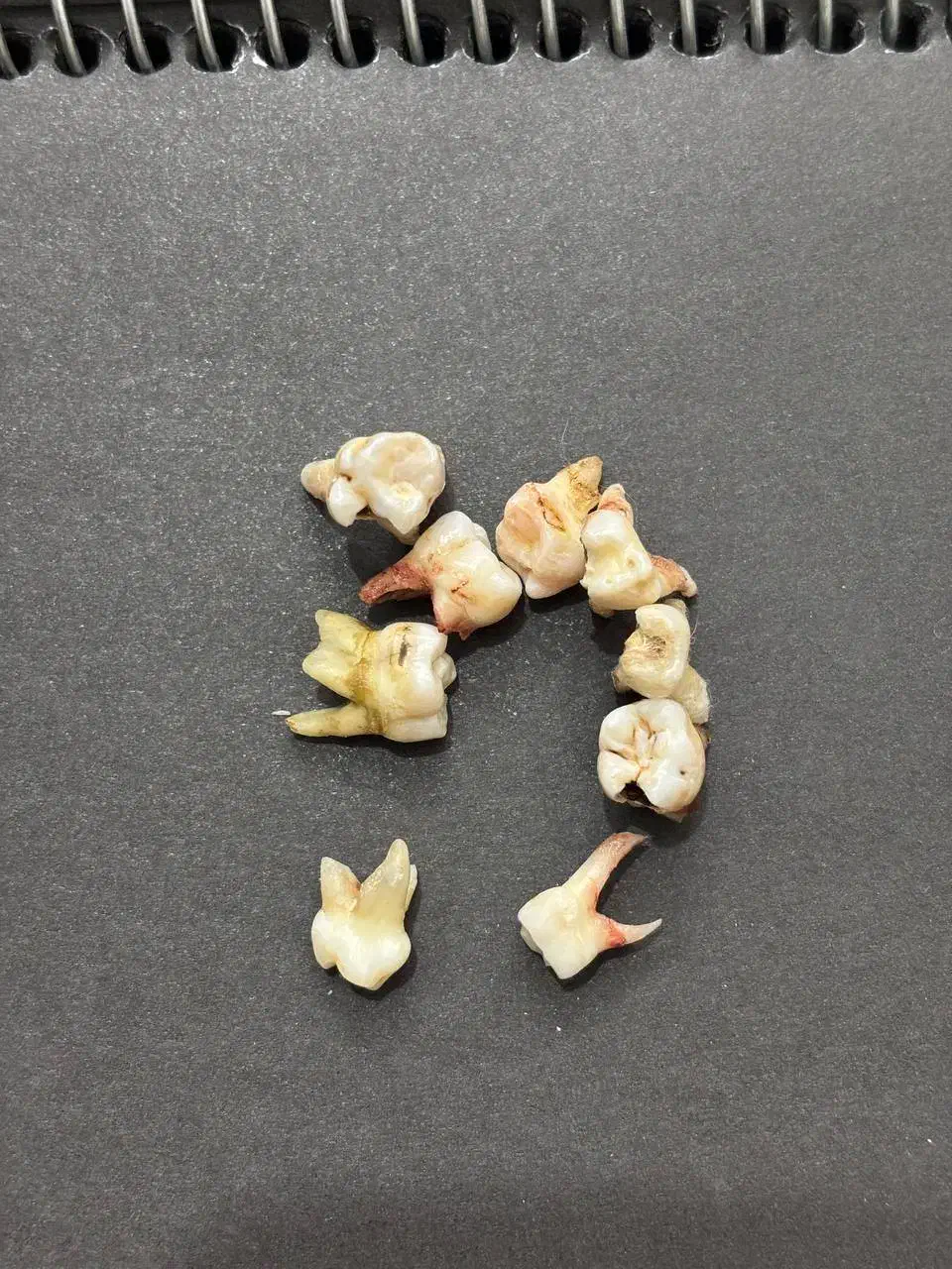 دندان شیری و دائمی برای دانشجویان|پزشکی|بیرجند, |دیوار