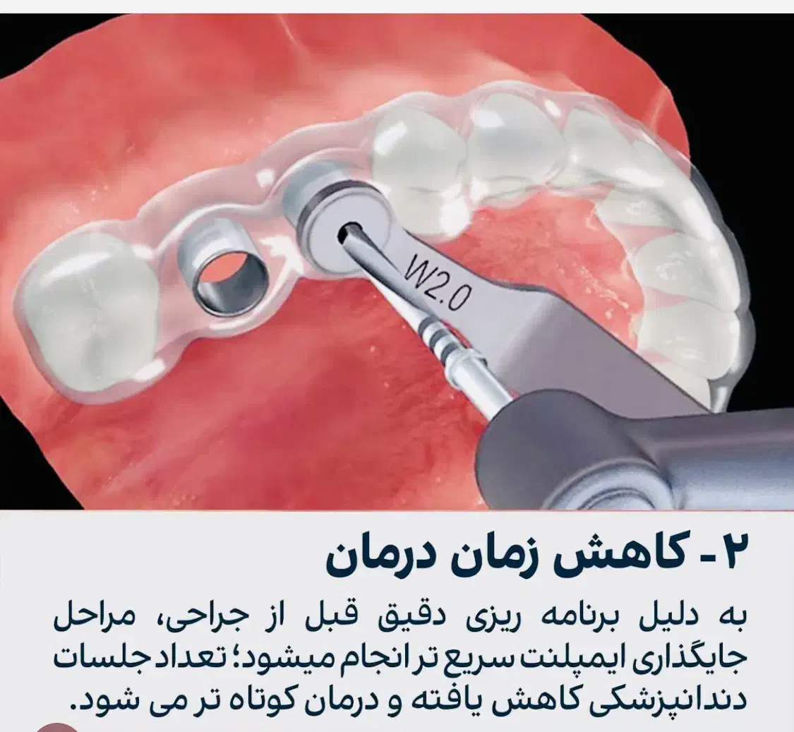 مرکزفوق تخصصی ایمپلنت دیجیتال/ایمپلنت فوری/بی درد|خدمات آرایشگری و زیبایی|مشهد, کوه سنگی|دیوار