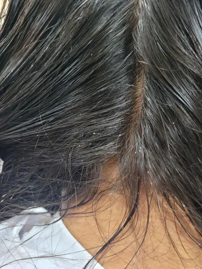 پاکسازی مو صد درصد تضمینی با یک جلسه|خدمات آرایشگری و زیبایی|قم, امامزاده ابراهیم|دیوار