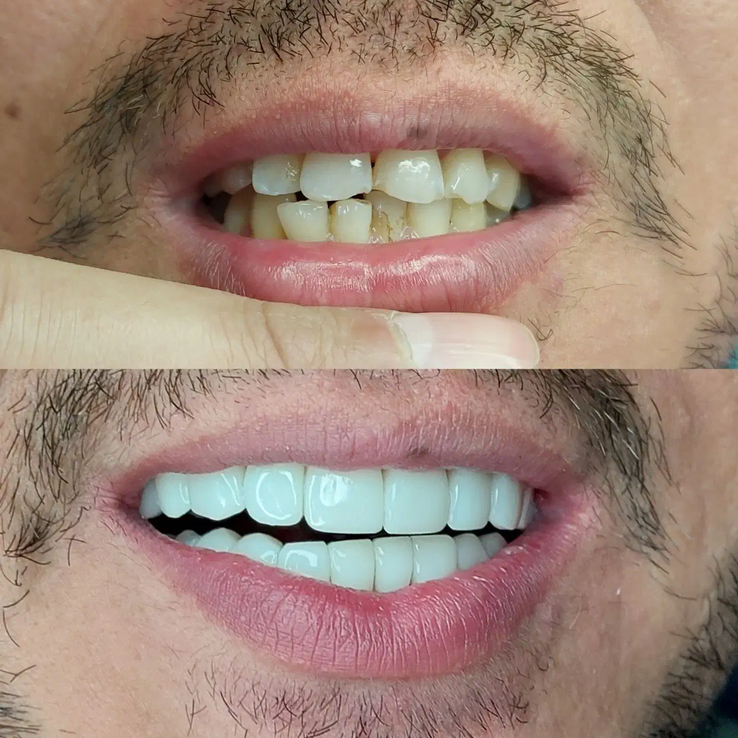 کامپوزیت زیبایی|خدمات آرایشگری و زیبایی|اسلام‌شهر, شهرک قائمیه|دیوار