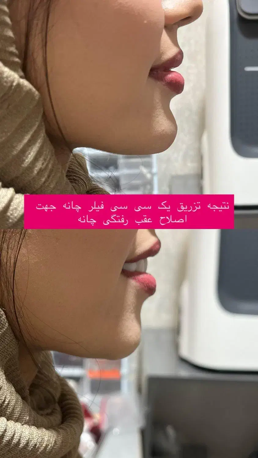 مطب زیبایی لیزر بوتاکس ژل مزو نخ لک جوش|خدمات آرایشگری و زیبایی|لردگان, |دیوار