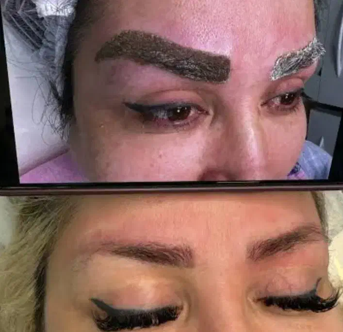 پاک کردن تتو با اسید میوه با بهترین مواد|خدمات آرایشگری و زیبایی|دماوند, دماوند|دیوار