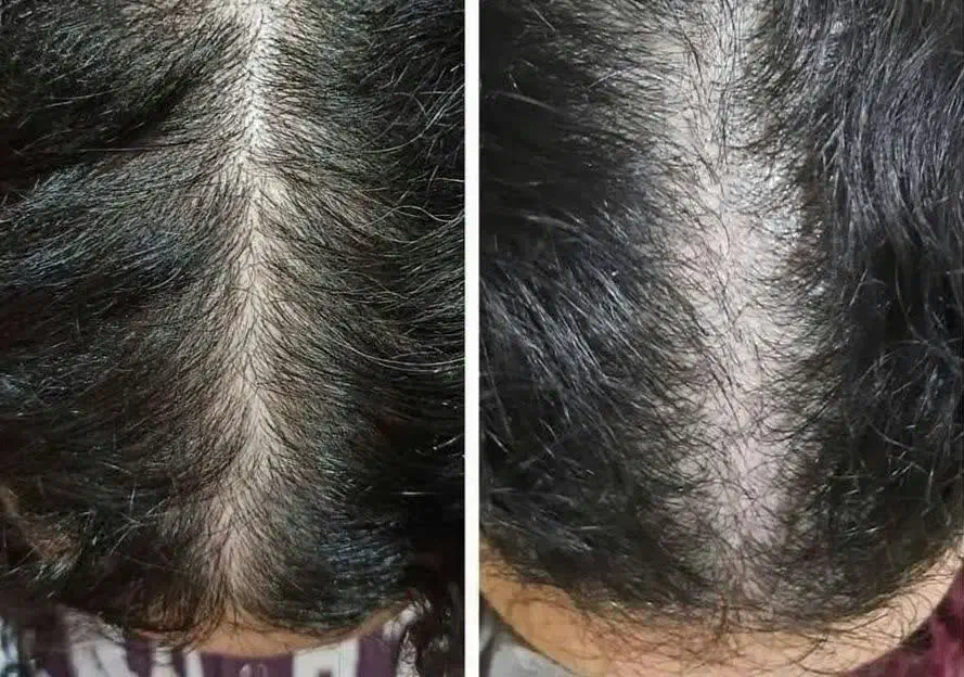 روغن تقویت مو|آرایشی، بهداشتی، درمانی|رفسنجان, |دیوار