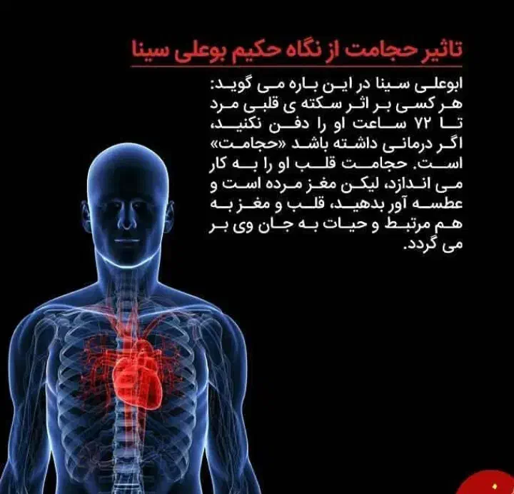 خدمات حجامت ،بادکش و ماساژ درمانی|خدمات آرایشگری و زیبایی|زابل, |دیوار