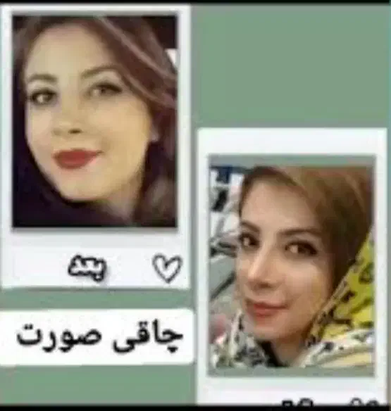 بمب چاقی صورت|خوردنی و آشامیدنی|شیراز, عفیف‌آباد|دیوار