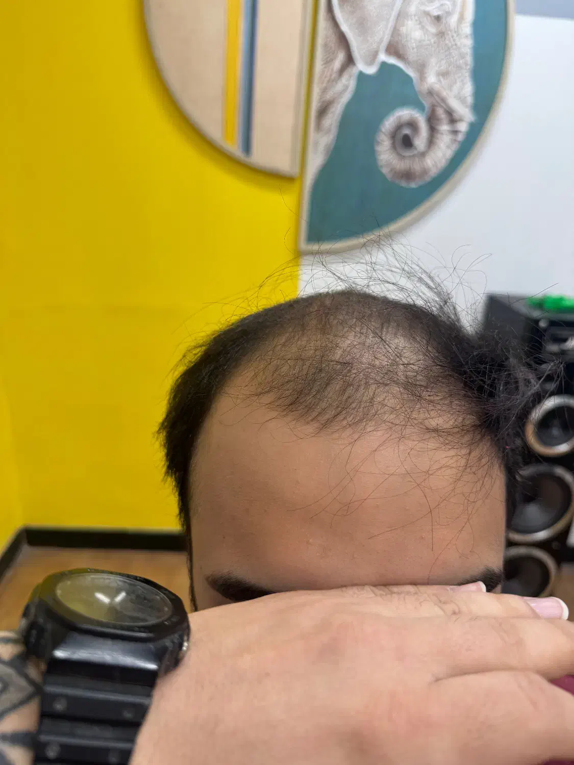 پروتز مو فروش و تعمیرات تخصصی|خدمات آرایشگری و زیبایی|تهران, تهرانپارس غربی|دیوار