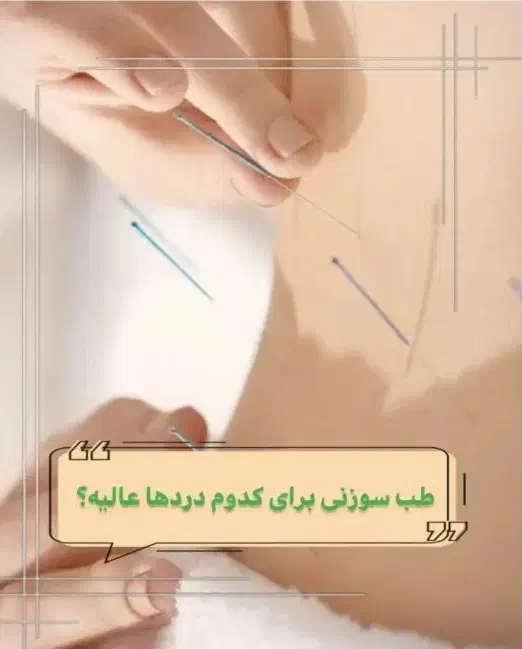 ماساژ حجامت بادکش زالو طب سوزنی فصد امبدینگ آموزش|خدمات آموزشی|اصفهان, فیض|دیوار