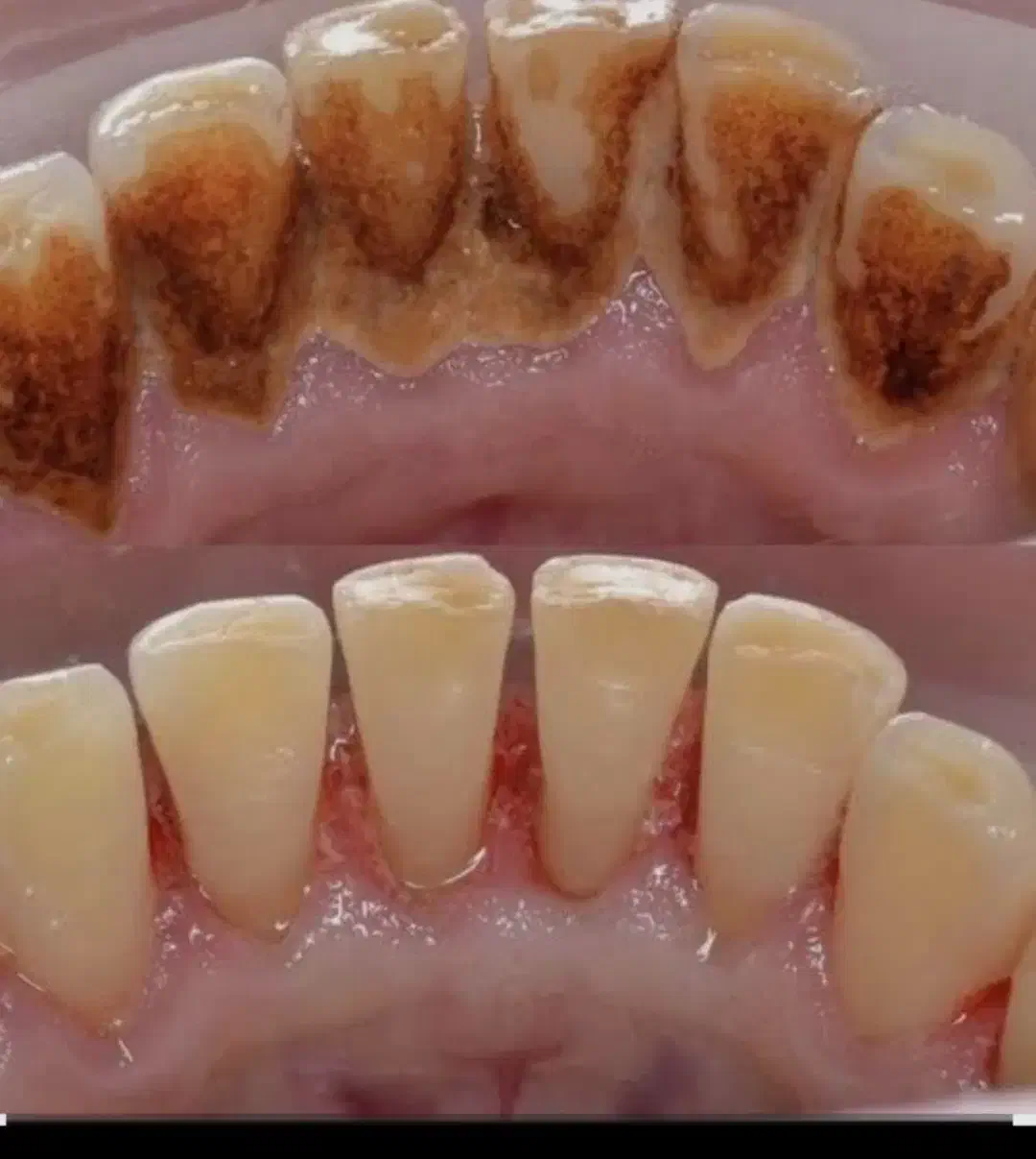 خدمات درمانی و زیبایی دندان|خدمات آرایشگری و زیبایی|کرمانشاه, |دیوار