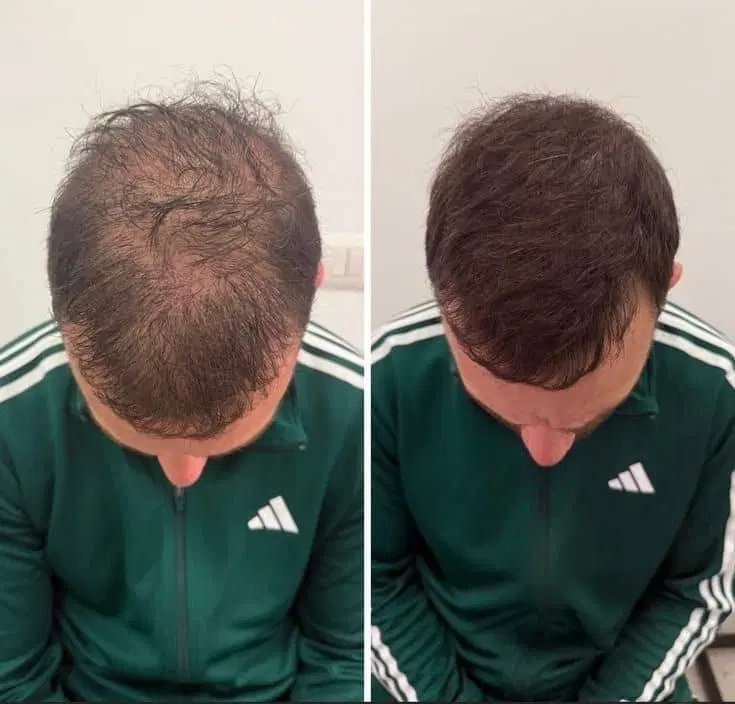 کاشت ممنوع|آرایشی، بهداشتی، درمانی|کرمانشاه, |دیوار