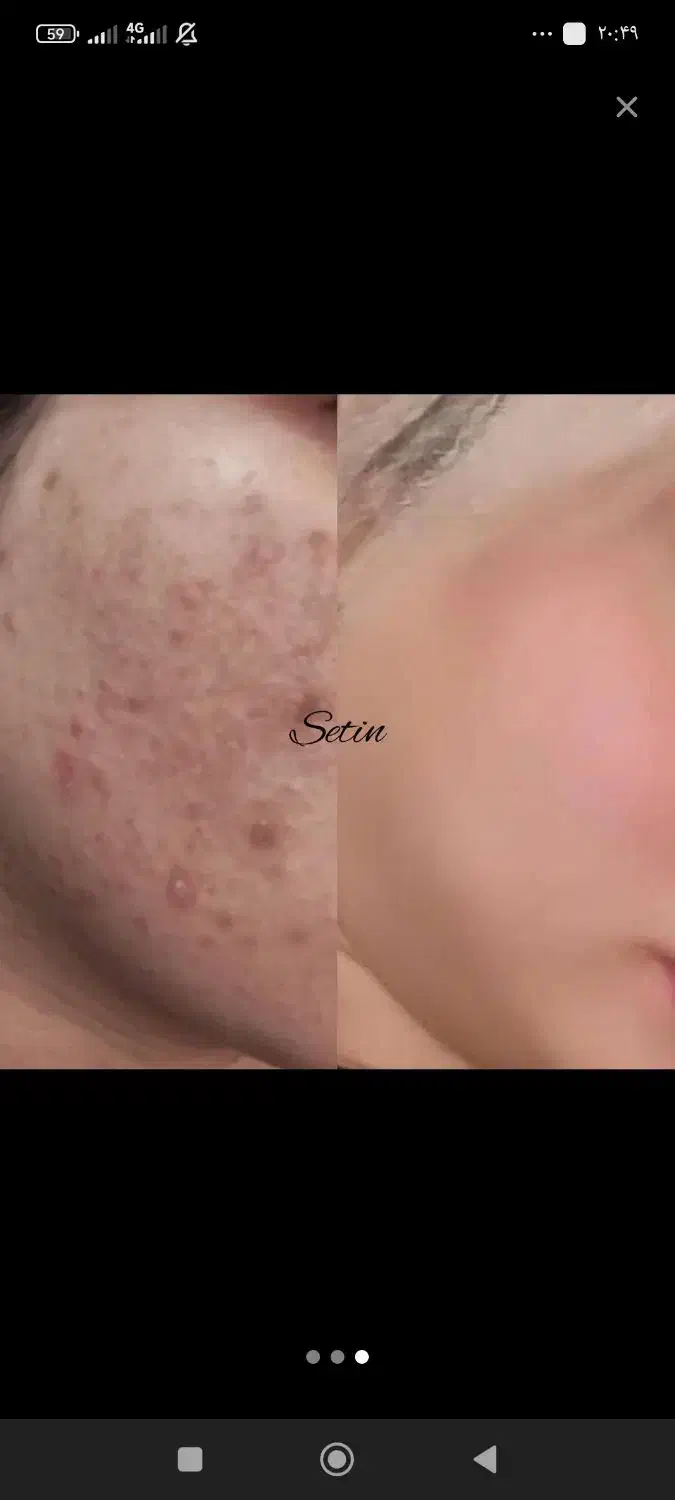 معجزه زیبایی|آرایشی، بهداشتی، درمانی|بروجن, |دیوار