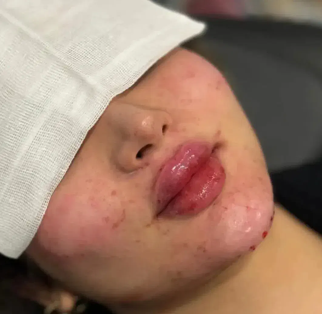 مرکز تخصصی ژل بوتاکس /کاشت امبدینگ لاغری در مطب|خدمات آرایشگری و زیبایی|کرمانشاه, |دیوار