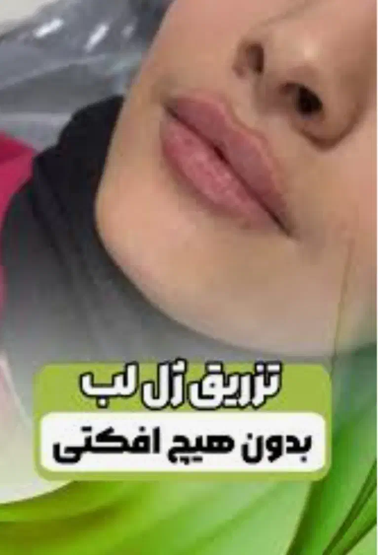 پروتوکین تراپی تخفیف ویژه روز دانشجو|خدمات آرایشگری و زیبایی|زاهدان, |دیوار