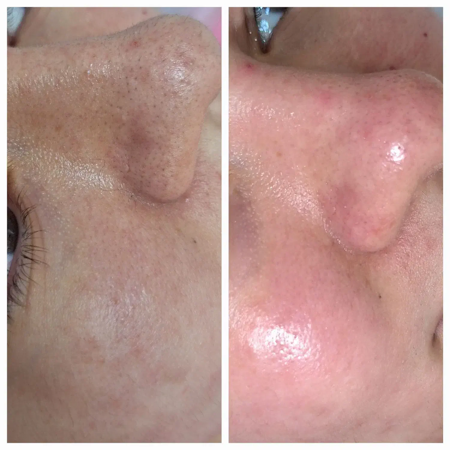 پاکسازی(faical)تخصصی در کلینیک زیبایی اردبیل|خدمات آرایشگری و زیبایی|اردبیل, |دیوار