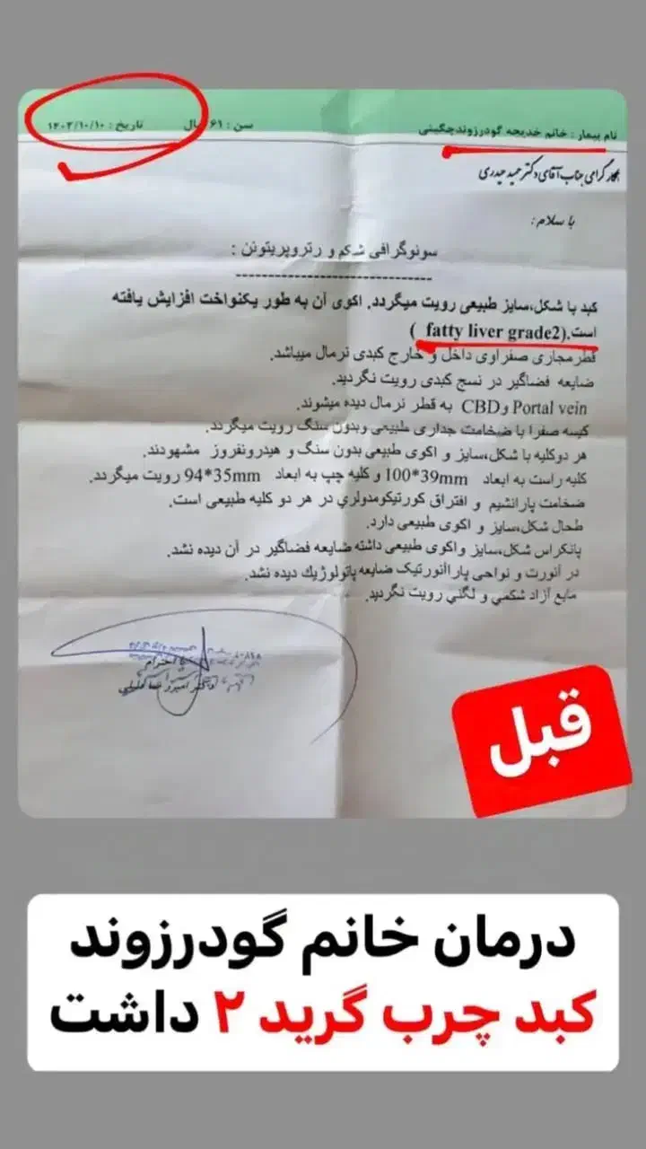 اگه درگیر کبد چرب هستی پیام بده|آرایشی، بهداشتی، درمانی|امامزاده عبدالله, |دیوار