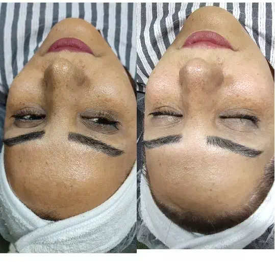 بمب تخفیفات فیشال و خدمات پوستی شروع قیمت از ۱۸۸|خدمات آرایشگری و زیبایی|شیراز, فرگاز|دیوار
