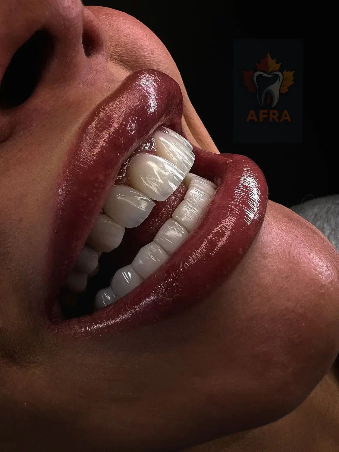 مدل کامپوزیت لیرینگ|خدمات آرایشگری و زیبایی|تهران, اباذر|دیوار