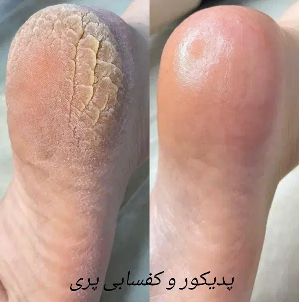 اولین کلینیک تخصصی پدیکور پا|خدمات آرایشگری و زیبایی|کرمانشاه, |دیوار